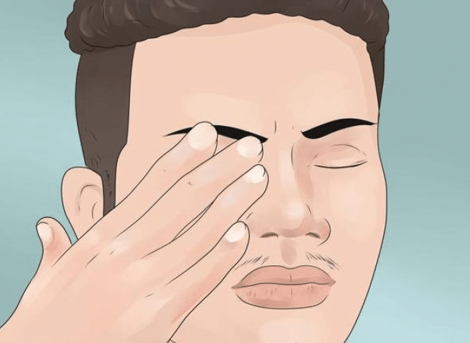 chứng sợ ánh sáng