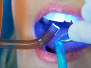 trattamento ultravioletto