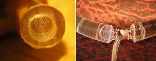 Dupka i kanterne på trbat