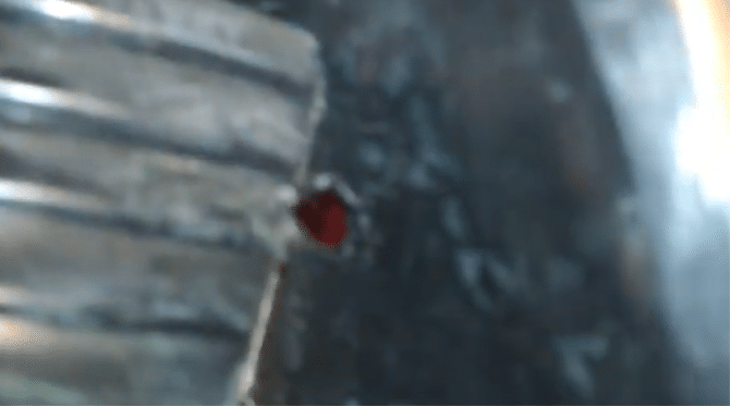 Dupki trong cơ thể